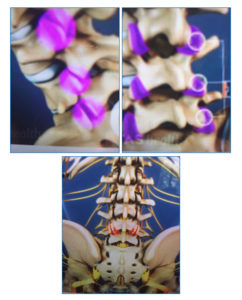 Osteoartritis De La Columna Vertebral Dr Fernando Larraguibel S Traumat Logo Especialista